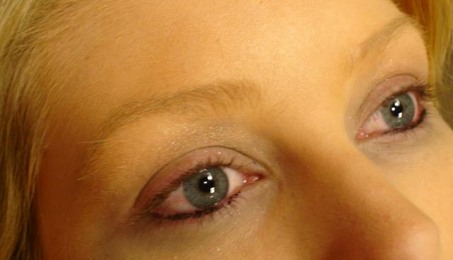 11-1-11_Before_Lashes_side_view.JPG