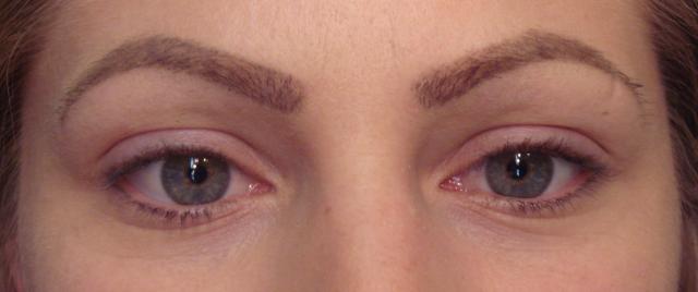 4-21-16_before_lashes.JPG
