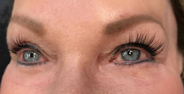 6-22-17_after_lashes_side_view.JPG